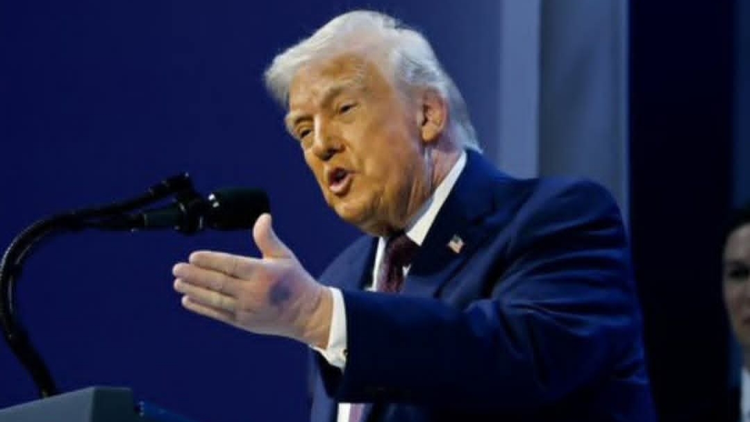 واکنش کاخ سفید به کبودی دست دونالد ترمپ